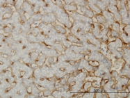 H00030845-M01 - EHD3