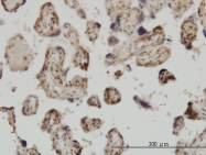 H00051003-M01 - MED31