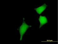 H00051022-B01P - Glutaredoxin-2 / GLRX2