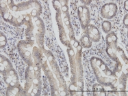 H00051024-M01 - FIS1 / TTC11