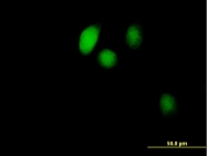 H00051027-B01P - BOLA1
