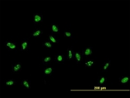 H00051042-B01 - ZNF593