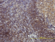 H00051100-M01 - Endophilin-B1