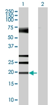 H00051155-B01 - HN1 / ARM2