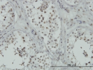 H00051187-M01 - RSL24D1