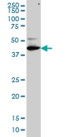 H00051270-M01 - TFDP3