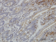 H00051283-M01 - BFAR / RNF47