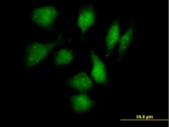 H00051314-B01P - TXNDC3 / SPTRX2