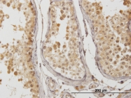 H00051382-M01 - ATP6V1D