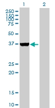 H00051422-B01P - AMPK gamma-2 chain / PRKAG2