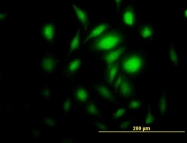 H00051422-B01P - AMPK gamma-2 chain / PRKAG2
