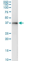 H00051422-D01 - AMPK gamma-2 chain / PRKAG2