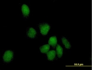 H00051426-B01 - DNA polymerase kappa