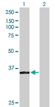 H00051426-D01P - DNA polymerase kappa