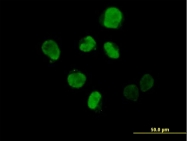 H00051447-B01P - InsP6 kinase 2 / IP6K2