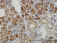 H00051458-M06 - RHCG