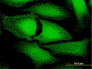 H00051479-B01P - ANKFY1