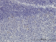 H00051491-M01 - NOP16