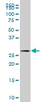 H00051540-A01 - Selenocysteine lyase (SCLY)