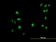 H00051545-B01 - ZNF581