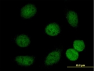 H00051564-B01 - HDAC7
