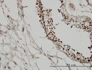 H00051592-M01 - TIF1-gamma / TRIM33