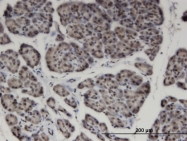 H00051710-M01 - ZNF44