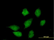 H00051727-B01 - CMPK1