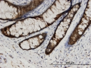 H00051727-M03 - CMPK1