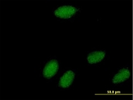 H00051728-B01 - POLR3K