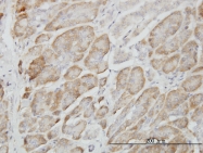 H00051735-M01 - RAPGEF6