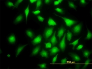 H00051735-M01 - RAPGEF6