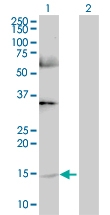 H00051738-B01 - Ghrelin / GHRL