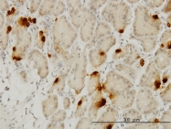 H00051738-M01 - Ghrelin / GHRL