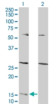 H00051738-M07 - Ghrelin / GHRL