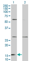 H00051738-M08 - Ghrelin / GHRL