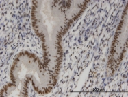 H00051804-M05 - SIX4