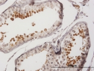 H00053340-B01P - Sperm protein 17 (SP17)