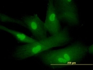 H00053340-B01P - Sperm protein 17 (SP17)