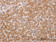 H00054101-M05 - RIPK4