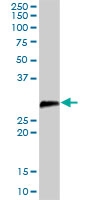H00054165-D01P - DCUN1D1