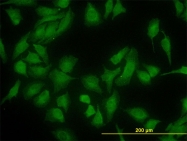 H00054431-M01 - DNAJC10 / ERDJ5