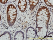H00054474-M01 - Cytokeratin 20