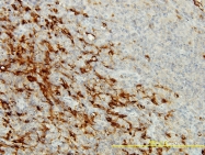 H00054504-M01 - CPVL