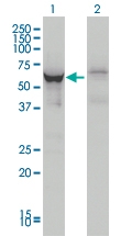 H00054606-M05 - DDX56