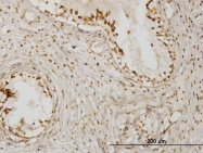 H00054758-M02 - KLHDC4