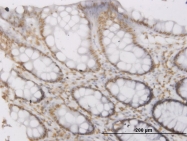H00054763-M03 - Ropporin-1A / ROPN1