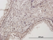H00054778-B01P - RNF111