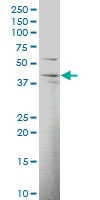 H00054788-A01 - DNAJB12