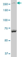 H00054880-A01 - Bcl-6 corepressor